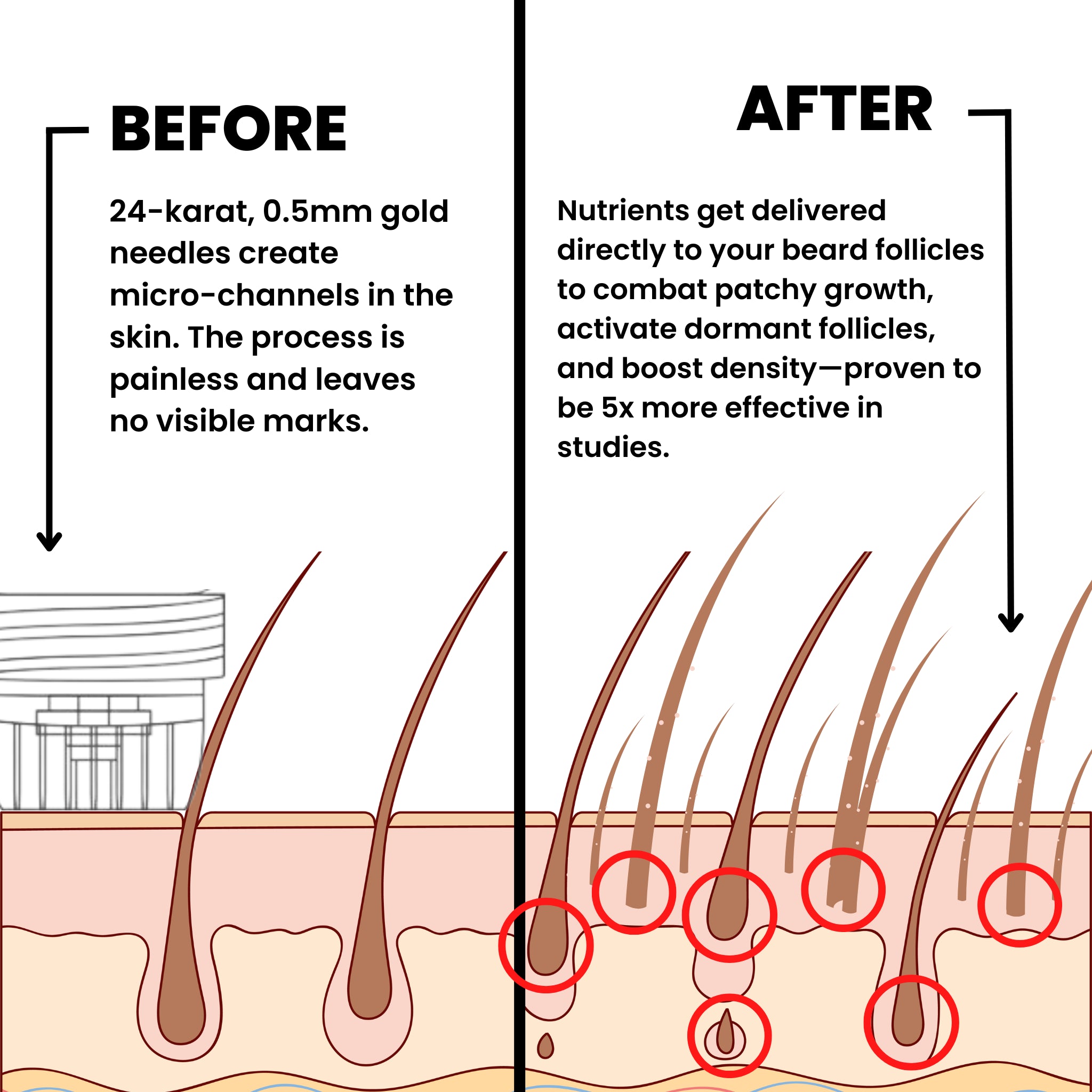 AlphaVance™ Beard Growth System