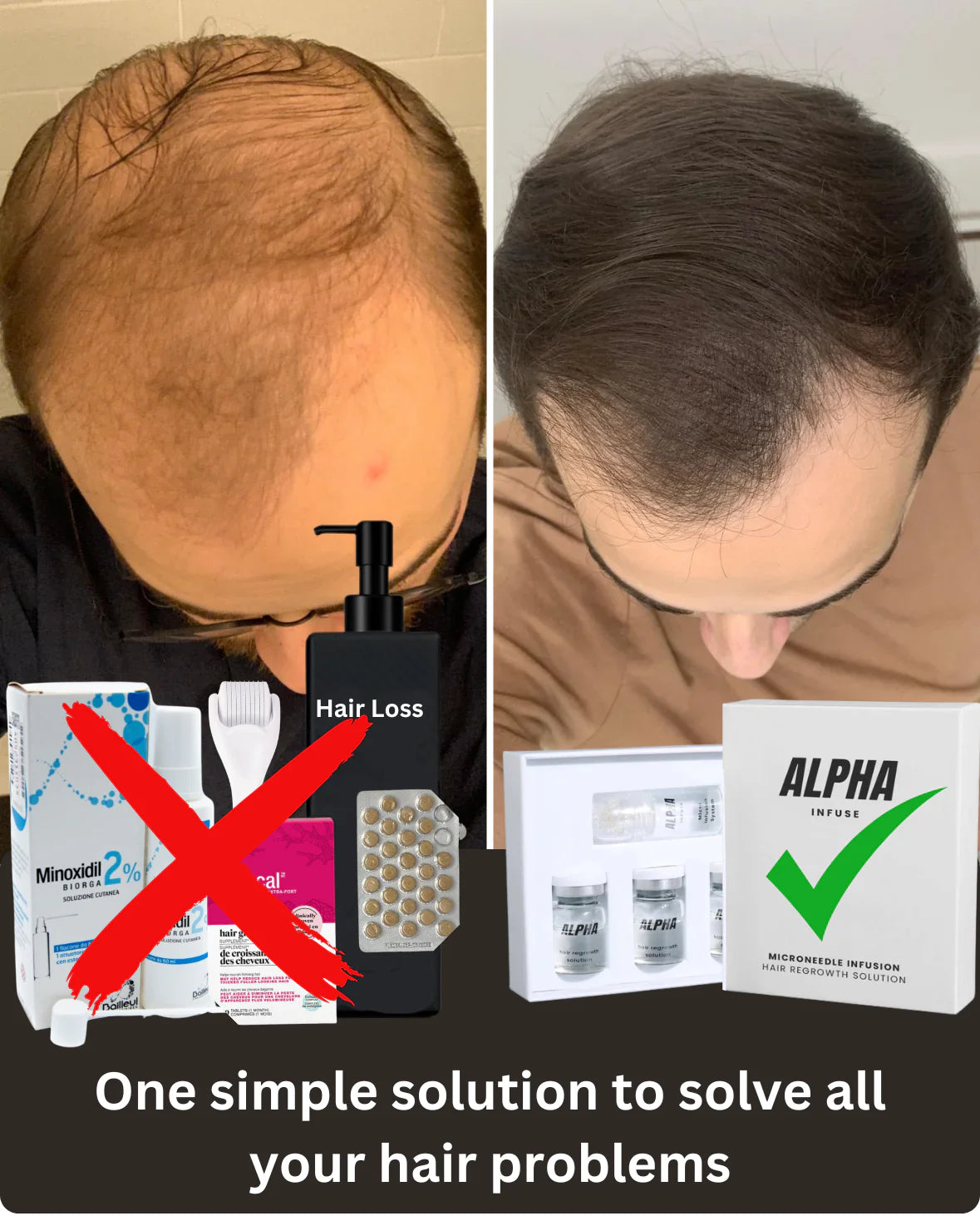 Before and after hair treatment comparison with product recommendation.