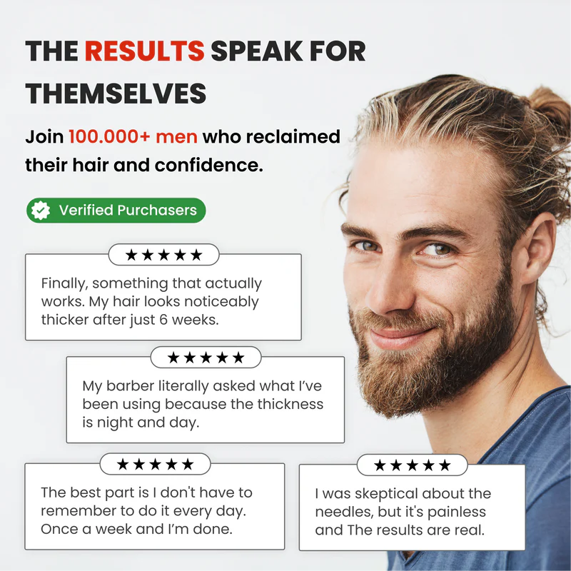 AlphaVance™ Hair Regrowth System