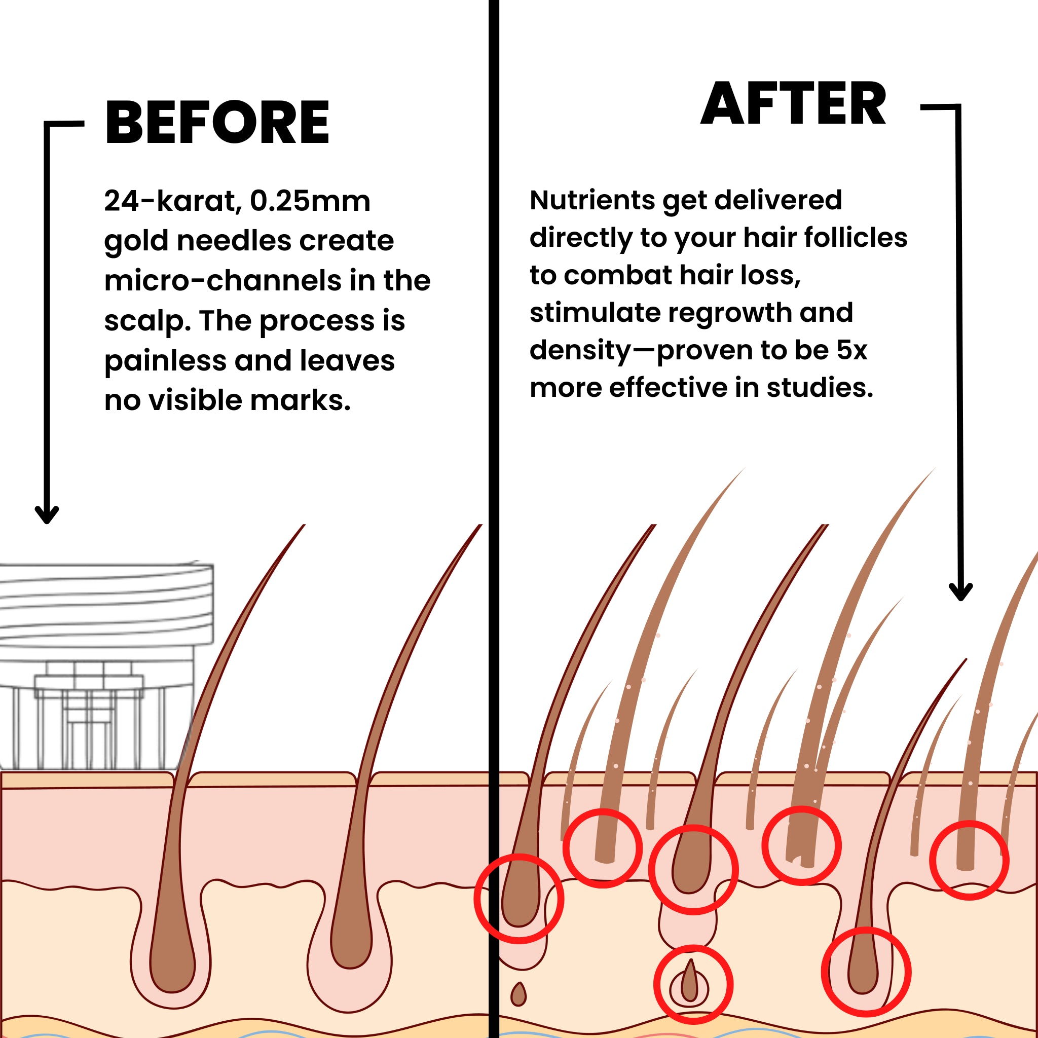 AlphaVance™ Hair Regrowth System Inbox